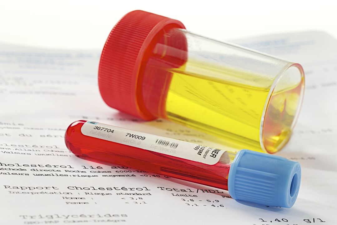 Blood and urine tests help determine the presence of prostatitis.