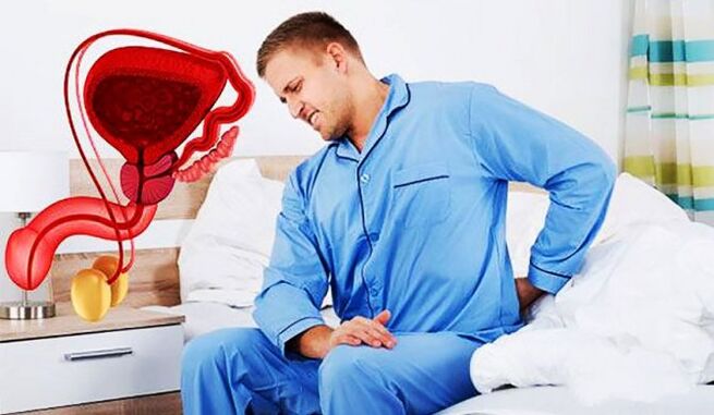back pain caused by prostatitis